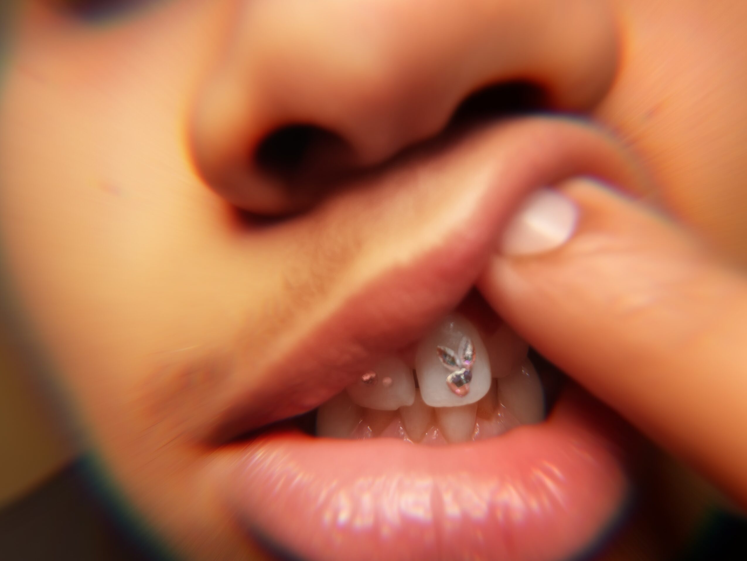 Close-up of a person's mouth with fingers touching teeth, showing braces and lip details.