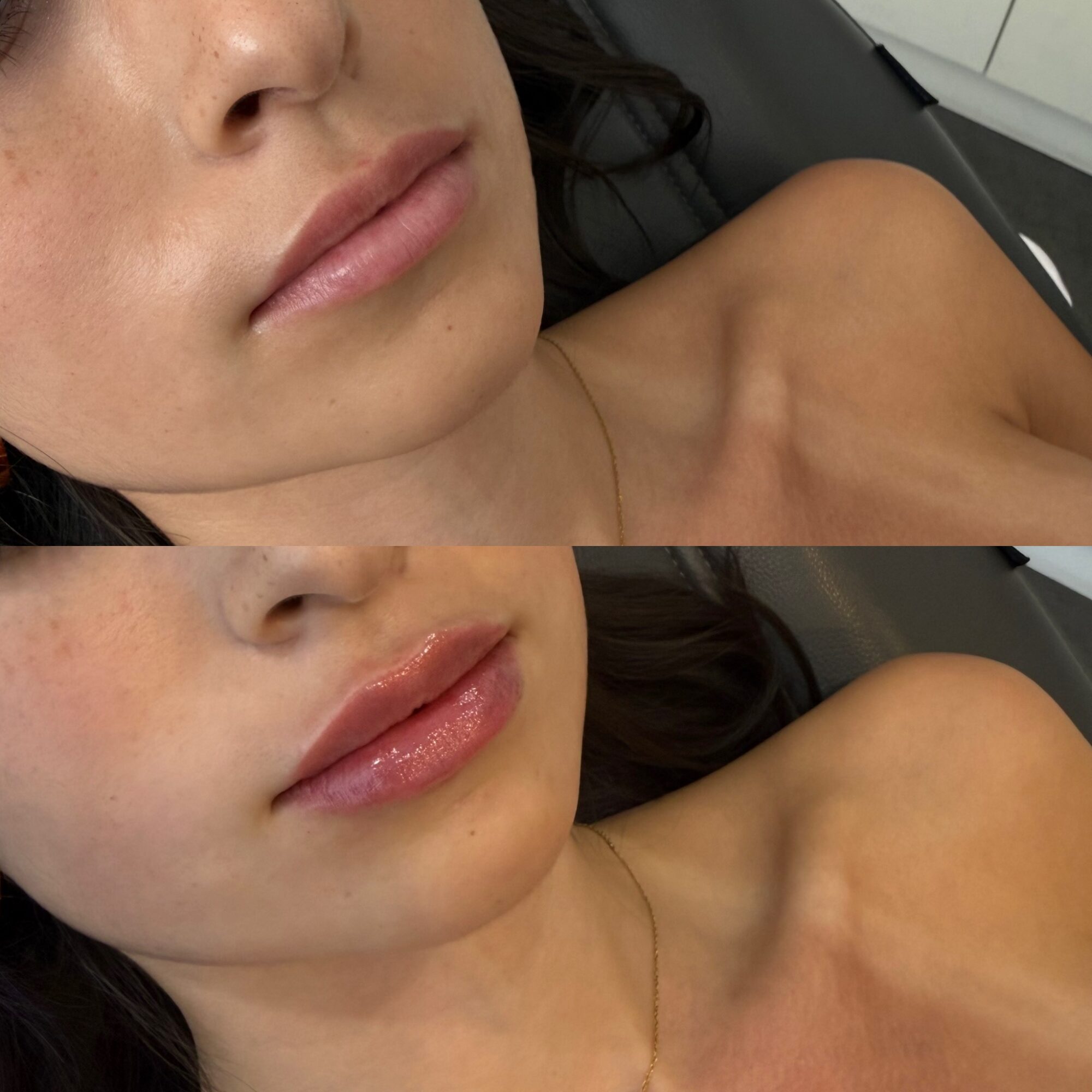 Close-up of a woman's face and shoulder, with lips slightly parted, showing smooth skin and a gold necklace.