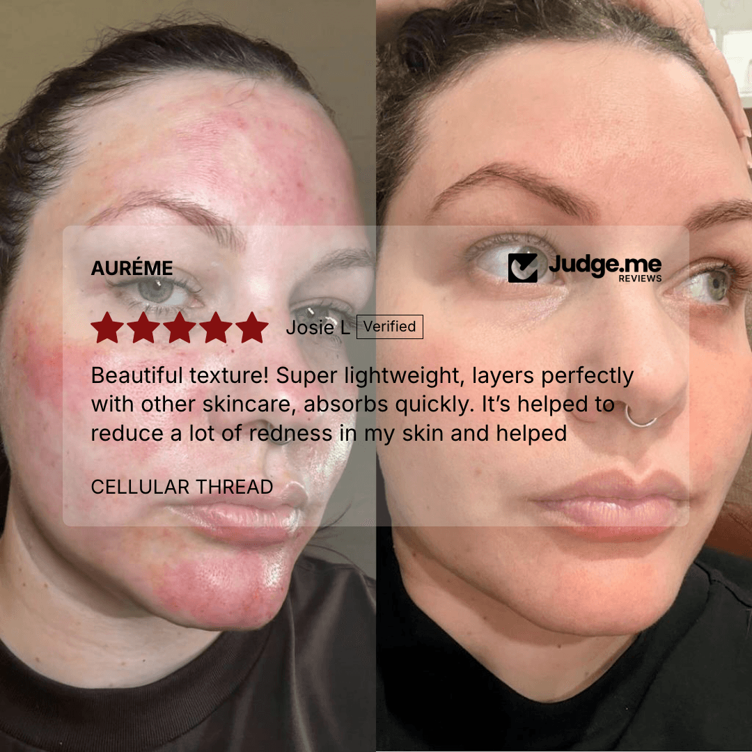 Comparison of skin before and after treatment showing reduced redness and clearer skin.