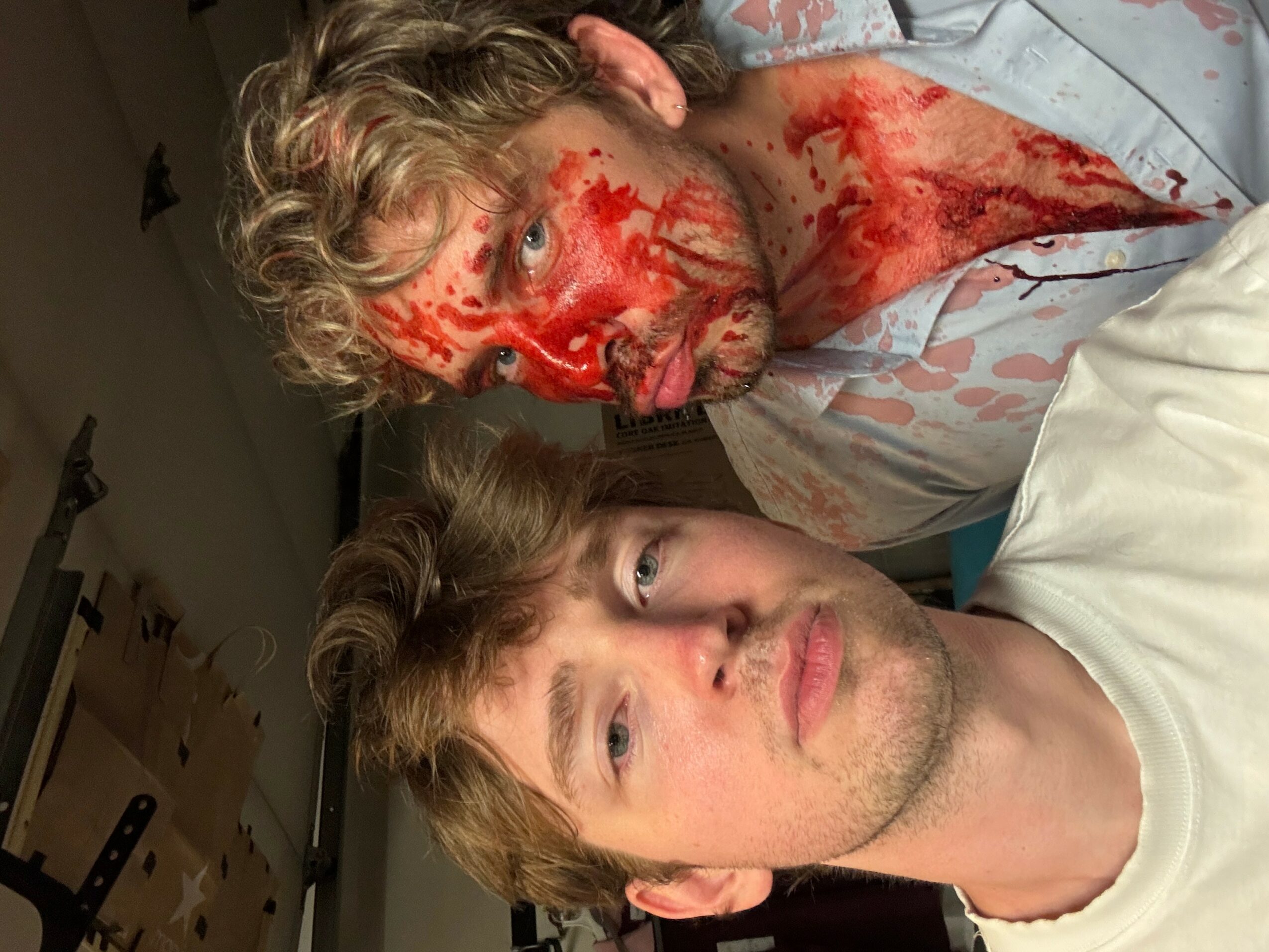 Two men, one with blood on face and shirt, lying on a hospital bed, with a neutral expression. Bright lighting.