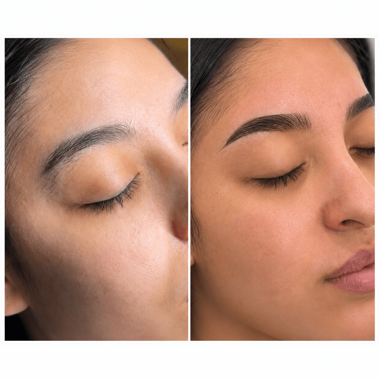 Side-by-side comparison of a woman's face before and after skincare, showing improved skin texture and clarity.