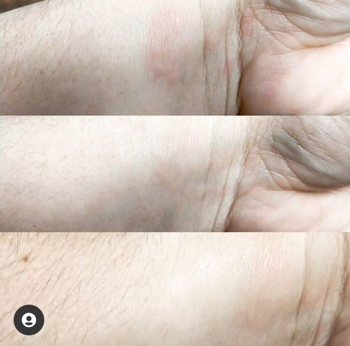 Close-up of a person's wrist with visible skin folds and fine hair, shown in three horizontal sections.